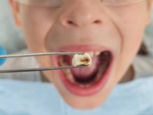 Best Same-Day Emergency Dentist in Medicine Lodge, KS