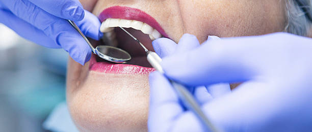 Best Emergency Tooth Extraction in Medicine Lodge, KS